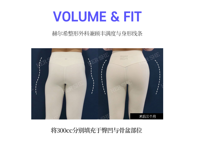 c3c794f17b9e113aa8860364dd9afd5b.png