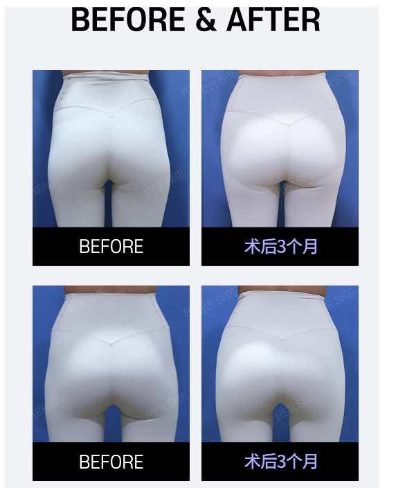 89f35343d5f52ba2f0a1c73f22ff1624.png