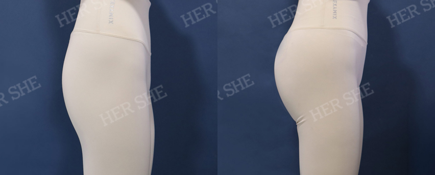 BEFORE & AFTER