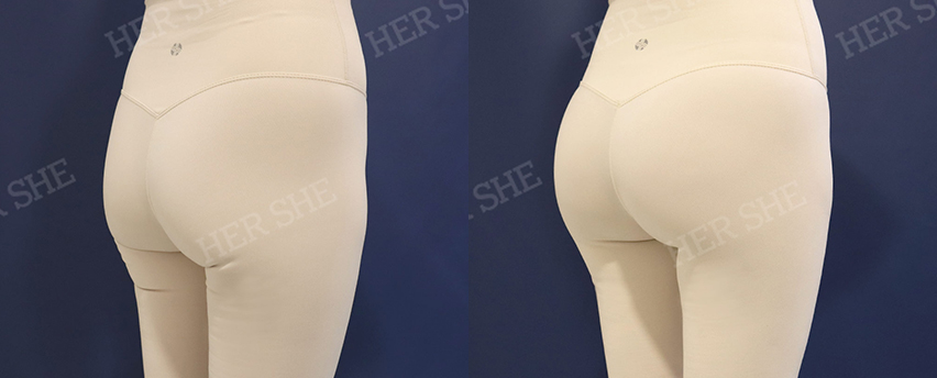 BEFORE & AFTER