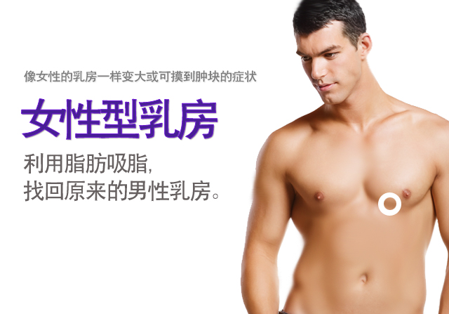 女性型乳房