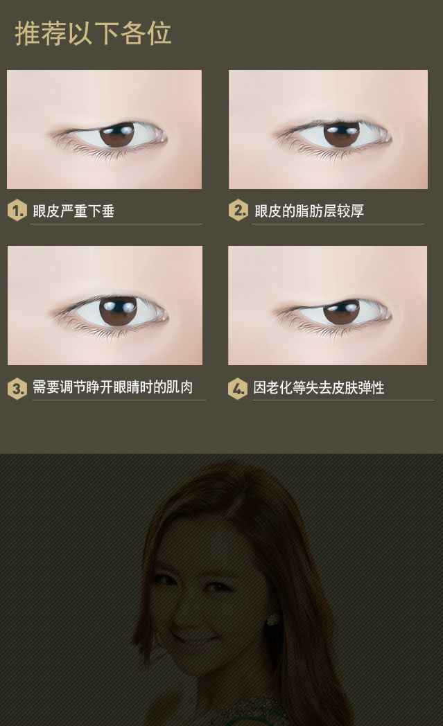 双眼皮