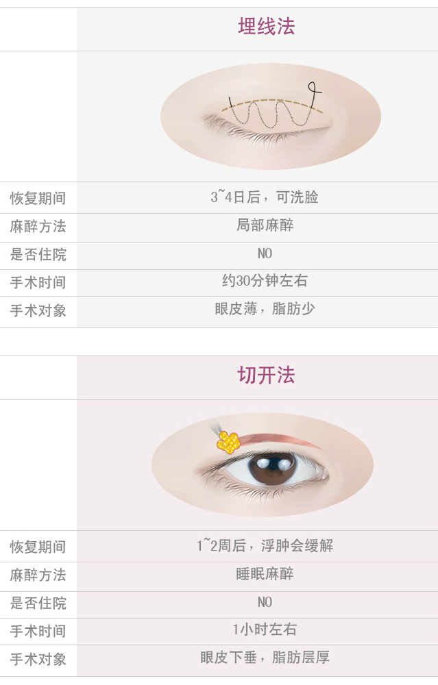 双眼皮