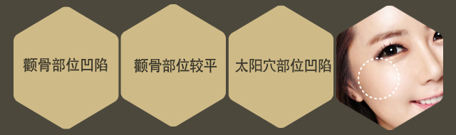 颧区
