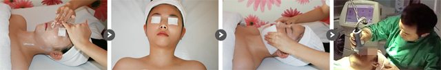 Особенности Picosure