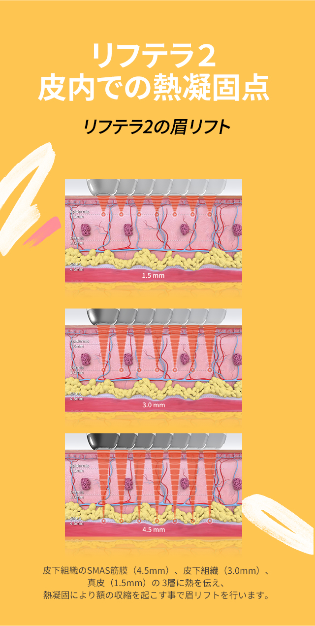 리프테라