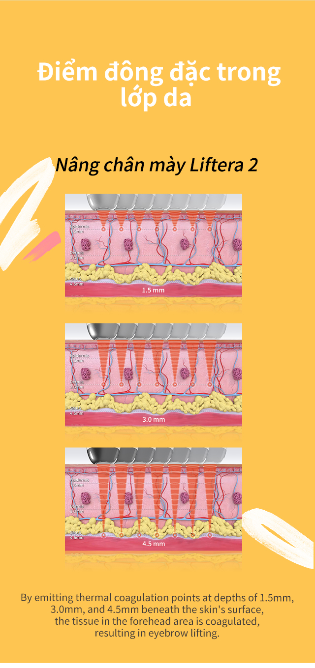 리프테라