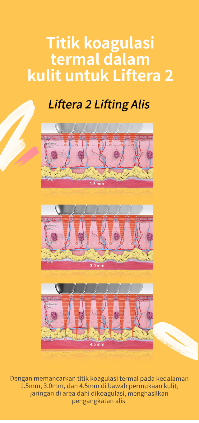 리프테라